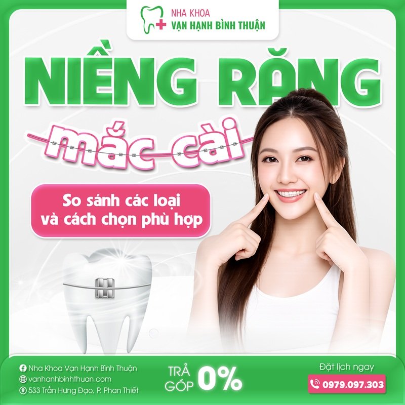 Niềng răng mắc cài: So sánh các loại và cách chọn phù hợp